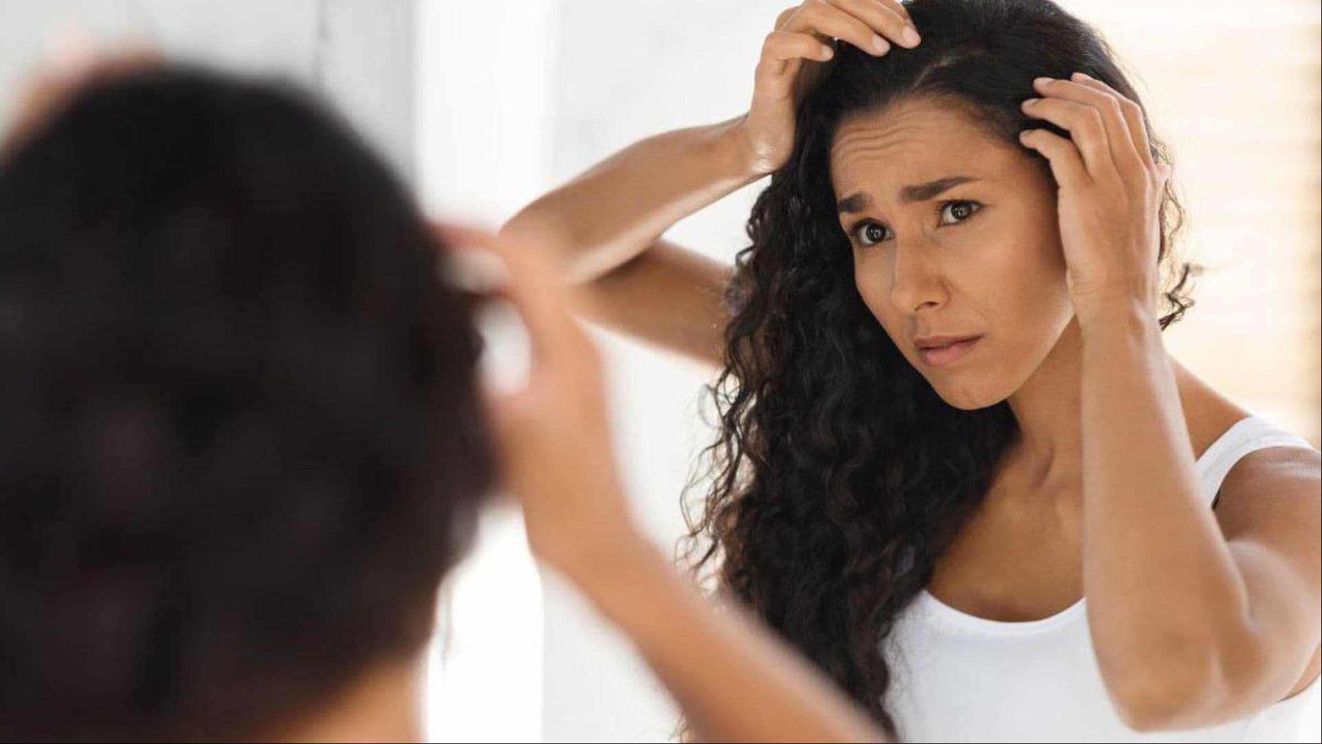 How do you know if it is Dandruff or Seborrheic Dermatitis?
