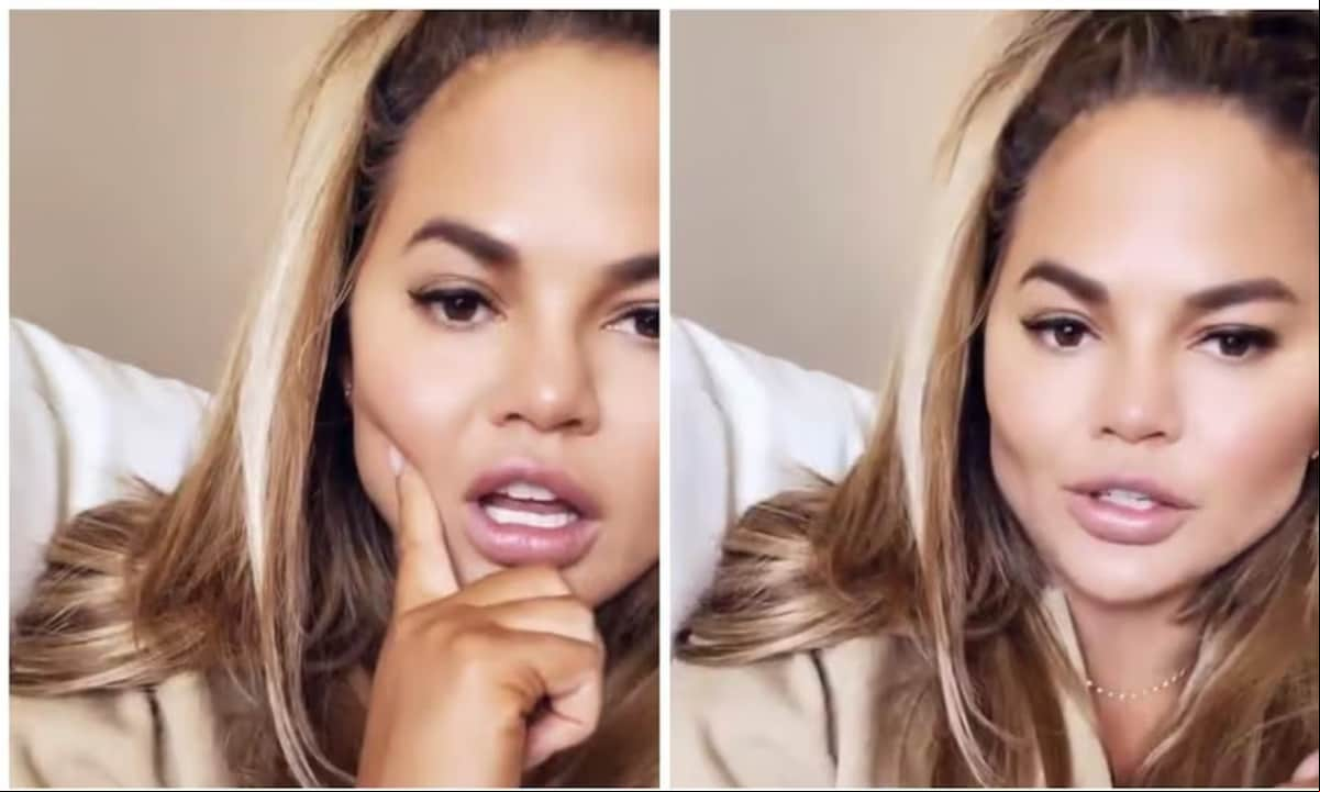 Chrissy showed off her buccal fat removal in 2021